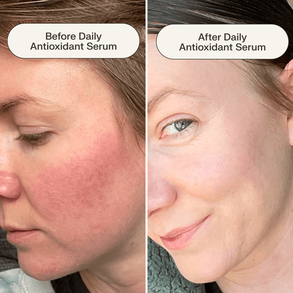 Daily Antioxidant Serum
